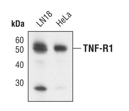 TNFR1 Antibody in Western Blot (WB)