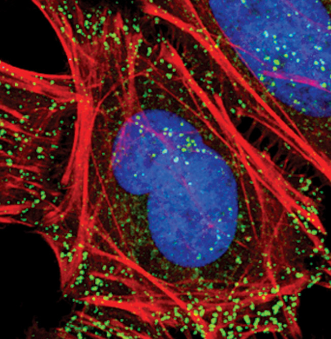 NUMB Antibody in Immunocytochemistry (ICC/IF)