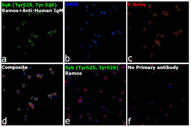 Phospho-Syk (Tyr525, Tyr526) Antibody in Immunocytochemistry (ICC/IF)