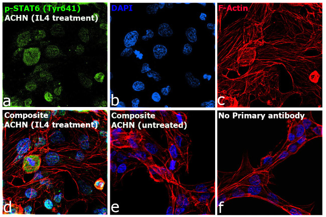 Phospho-STAT6 (Tyr641) Antibody in Immunocytochemistry (ICC/IF)