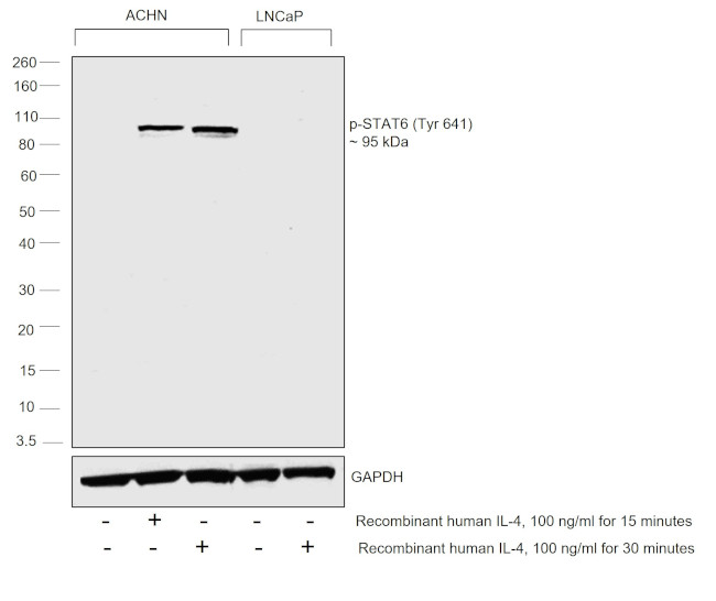 Phospho-STAT6 (Tyr641) Antibody in Western Blot (WB)