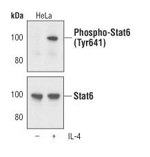 Phospho-STAT6 (Tyr641) Antibody in Western Blot (WB)