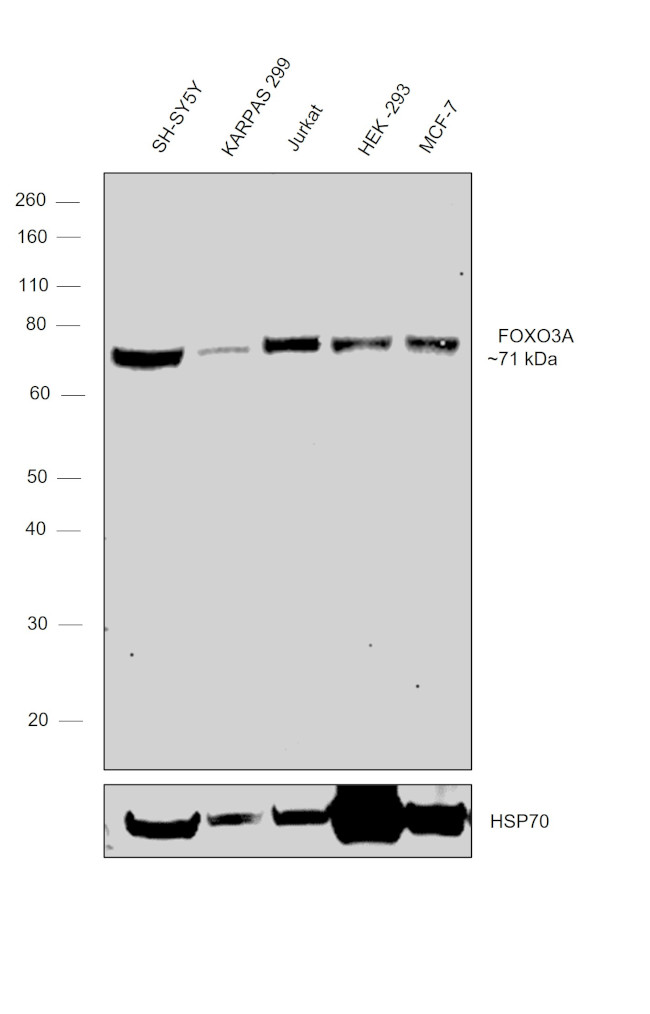 FOXO3A Antibody in Western Blot (WB)