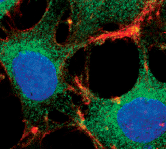 FOXO3A Antibody in Immunocytochemistry (ICC/IF)