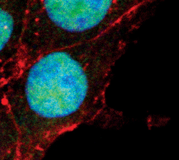 FOXO3A Antibody in Immunocytochemistry (ICC/IF)