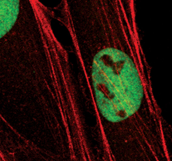 LSD1 Antibody in Immunocytochemistry (ICC/IF)