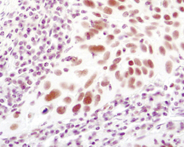 LSD1 Antibody in Immunohistochemistry (Paraffin) (IHC (P))