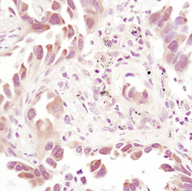 Thioredoxin 1 Antibody in Immunohistochemistry (Paraffin) (IHC (P))