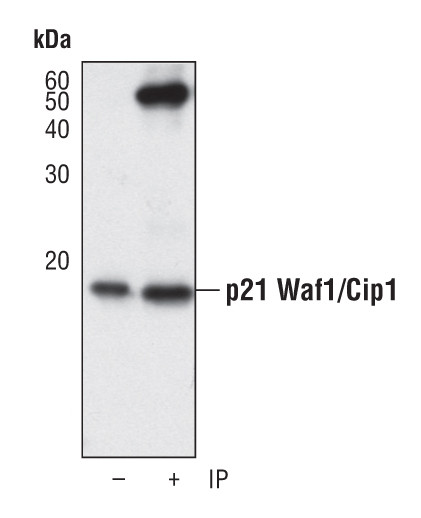 p21 Antibody in Immunoprecipitation (IP)