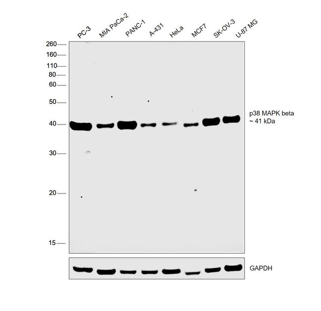 p38 MAPK beta Antibody in Western Blot (WB)