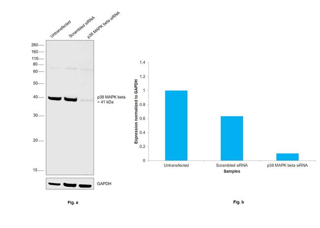 p38 MAPK beta Antibody in Western Blot (WB)