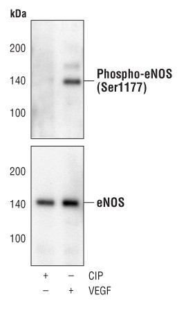 Phospho-eNOS (Ser1177) Antibody in Western Blot (WB)