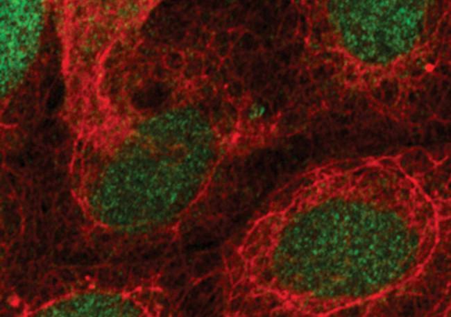 LEF1 Antibody in Immunocytochemistry (ICC/IF)