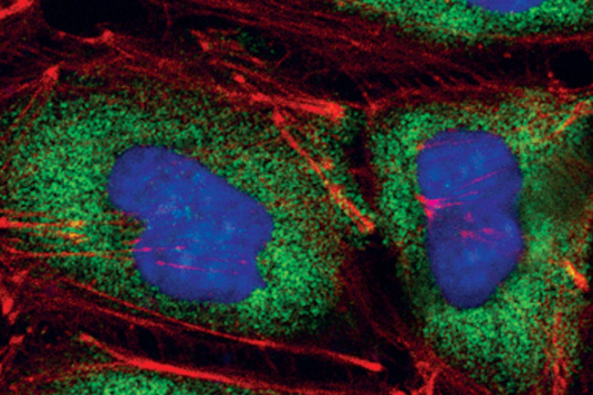 eIF4G Antibody in Immunocytochemistry (ICC/IF)