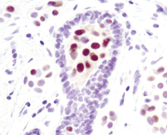 Phospho-STAT5 alpha (Tyr694) Antibody in Immunohistochemistry (Paraffin) (IHC (P))