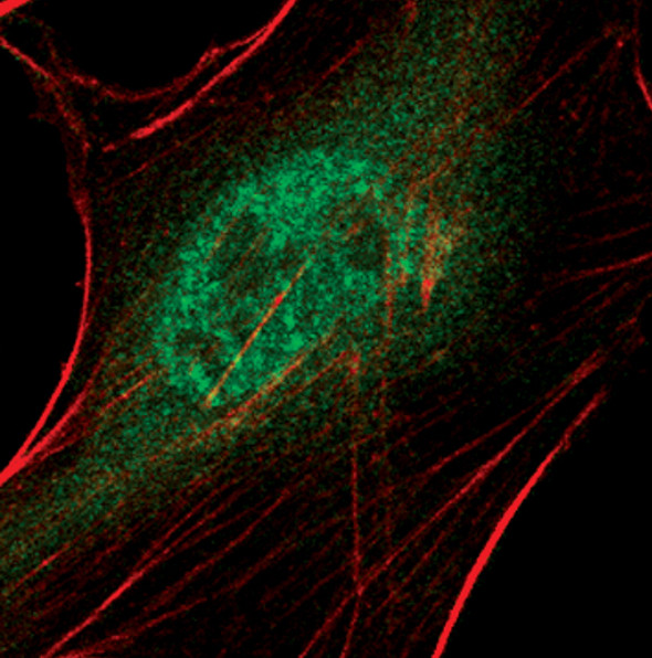 DAXX Antibody in Immunocytochemistry (ICC/IF)