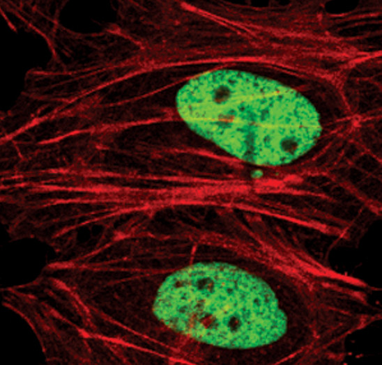 H3K4me2 Antibody in Immunocytochemistry (ICC/IF)