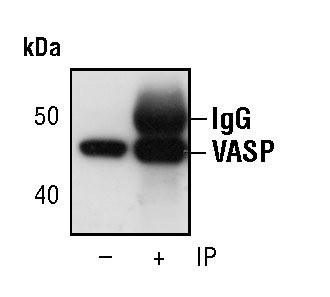 VASP Antibody in Immunoprecipitation (IP)