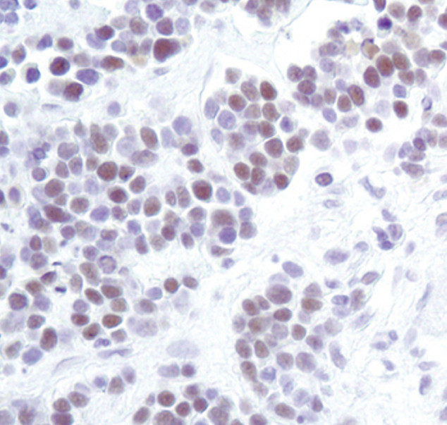 HP1 alpha Antibody in Immunohistochemistry (Paraffin) (IHC (P))