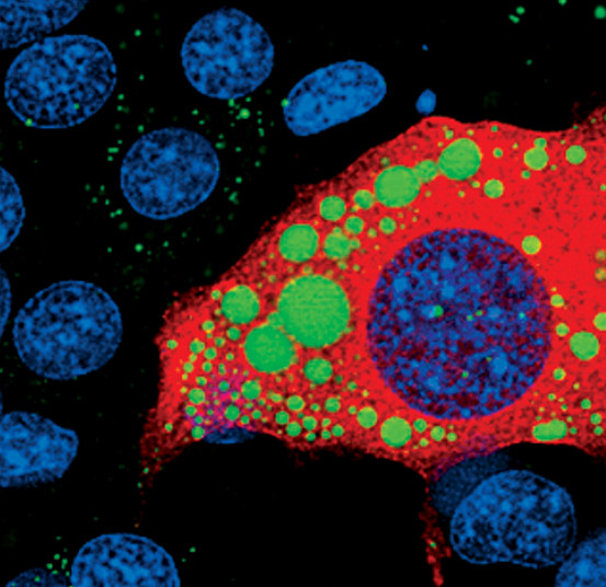 ATGL Antibody in Immunocytochemistry (ICC/IF)