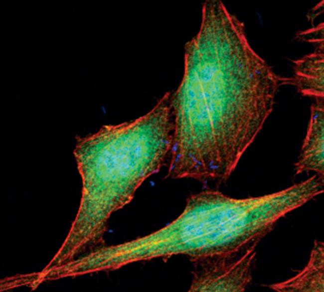 4EBP1 Antibody in Immunocytochemistry (ICC/IF)