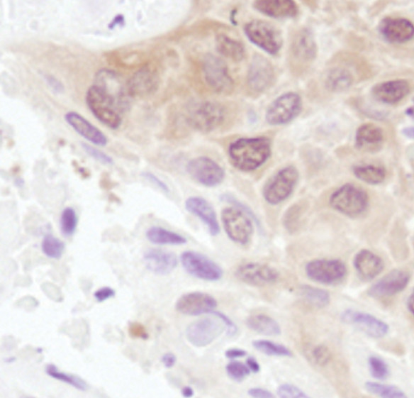 4EBP1 Antibody in Immunohistochemistry (Paraffin) (IHC (P))