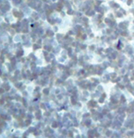 DRAK2 Antibody in Immunohistochemistry (Paraffin) (IHC (P))