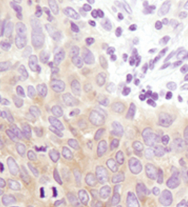 GYS1 Antibody in Immunohistochemistry (Paraffin) (IHC (P))