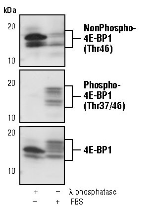 Nonphospho-4EBP1 (Thr46) Antibody in Western Blot (WB)