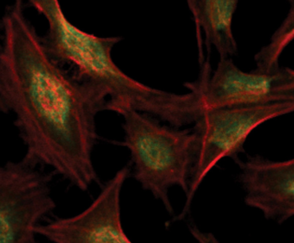 RSK1/RSK2/RSK3 Antibody in Immunocytochemistry (ICC/IF)