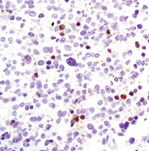 Caspase 8 (Cleaved Asp391) Antibody in Immunohistochemistry (IHC)