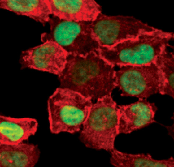 FosB Antibody in Immunocytochemistry (ICC/IF)