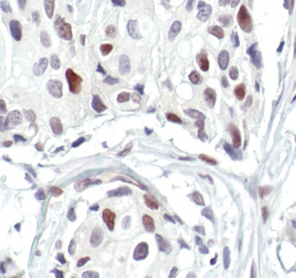 FosB Antibody in Immunohistochemistry (Paraffin) (IHC (P))