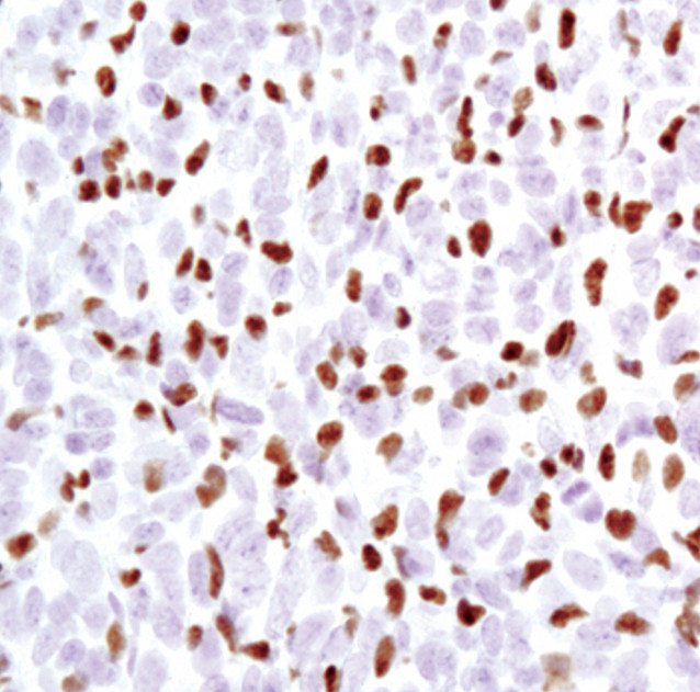 PU.1 Antibody in Immunohistochemistry (Paraffin) (IHC (P))