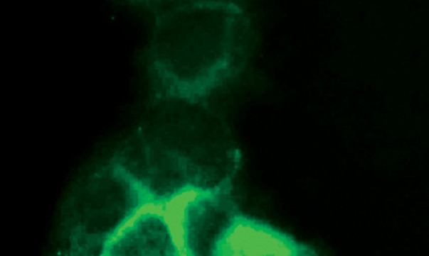 CEA Antibody in Immunocytochemistry (ICC/IF)