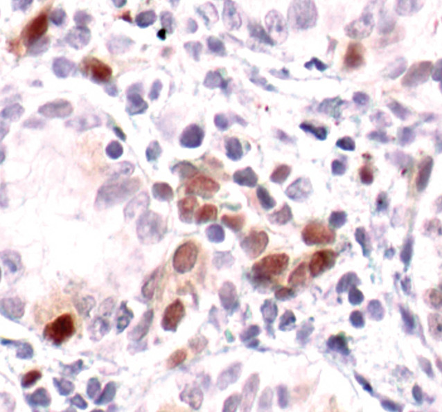 Phospho-STAT1 (Tyr701) Antibody in Immunohistochemistry (Paraffin) (IHC (P))