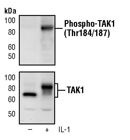 Phospho-TAK1 (Thr184, Thr187) Antibody in Western Blot (WB)