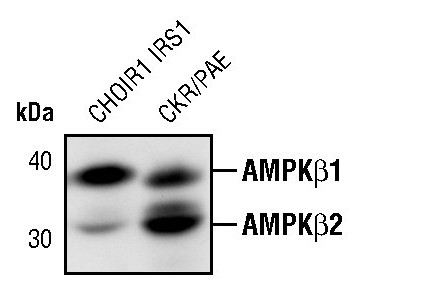 AMPK beta-1,2 Antibody in Western Blot (WB)