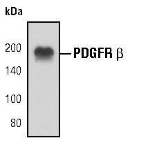 PDGFRB Antibody in Western Blot (WB)