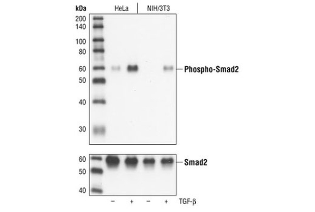 Phospho-SMAD2 (Ser465, Ser467) Antibody in Western Blot (WB)