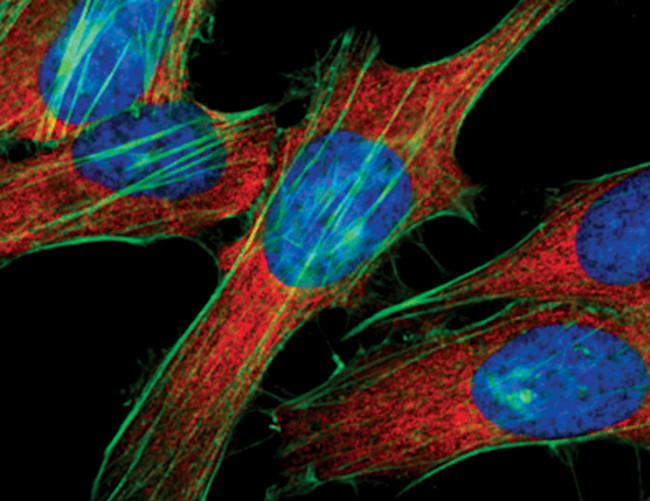 S6 Antibody in Immunocytochemistry (ICC/IF)