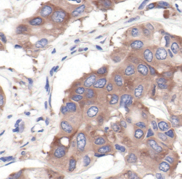 S6 Antibody in Immunohistochemistry (Paraffin) (IHC (P))