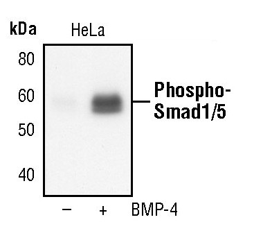 Phospho-SMAD1/SMAD5 (Ser463, Ser465) Antibody in Western Blot (WB)