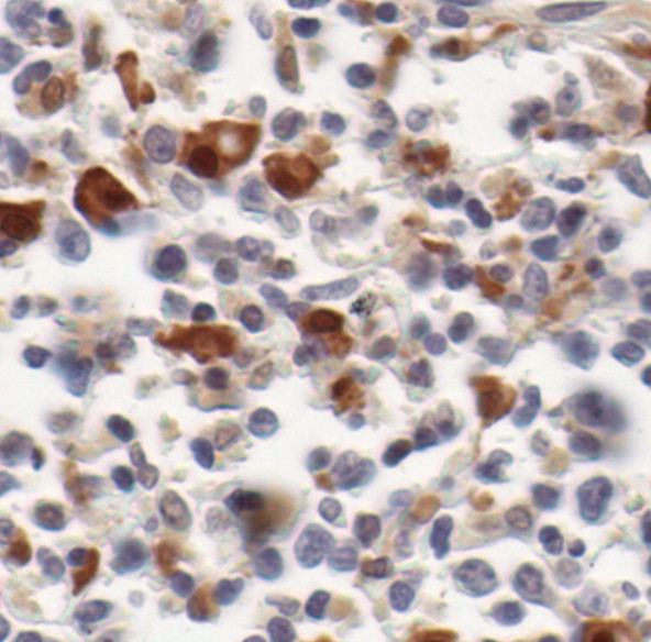 STAT1 Antibody in Immunohistochemistry (Paraffin) (IHC (P))