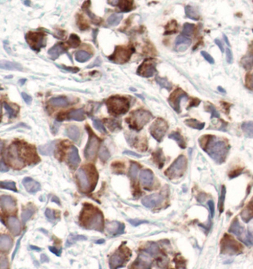 MUC1 Antibody in Immunohistochemistry (Paraffin) (IHC (P))