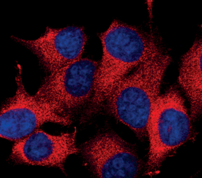 IkB alpha Antibody in Immunocytochemistry (ICC/IF)