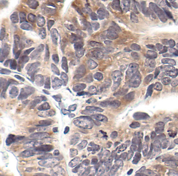 Phospho-EIF2S1 (Ser52) Antibody in Immunohistochemistry (Paraffin) (IHC (P))