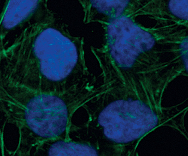 Phospho-S6 (Ser235, Ser236) Antibody in Immunocytochemistry (ICC/IF)