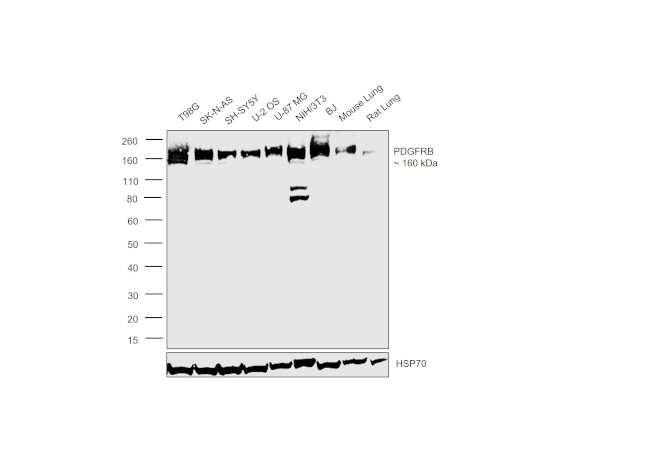 PDGFRB Antibody in Western Blot (WB)