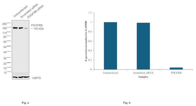 PDGFRB Antibody in Western Blot (WB)